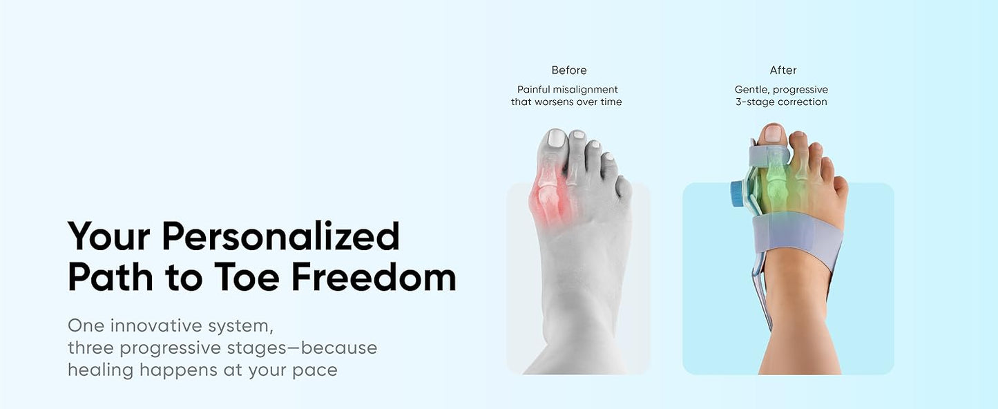 Silicone Bunion Alignment System